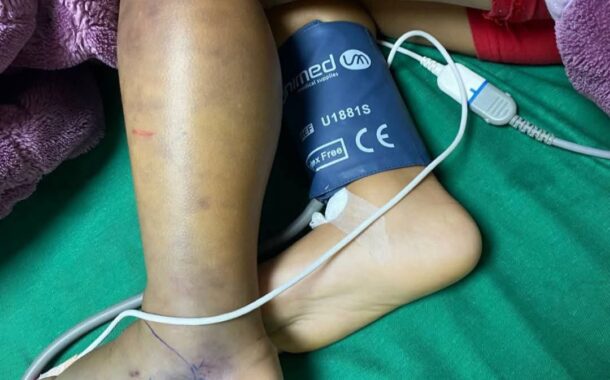 إبن ال 9 سنوات تعرض للدغة افعى سامة في الصوانة